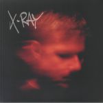 X Ray (B-STOCK)