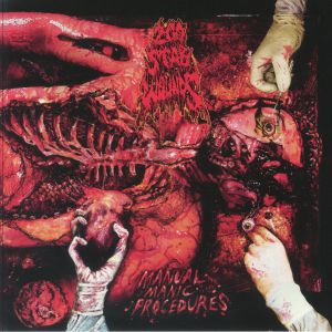 Manual Manic Procedures