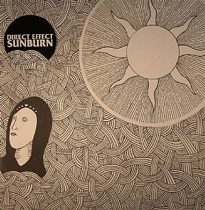 Sunburn