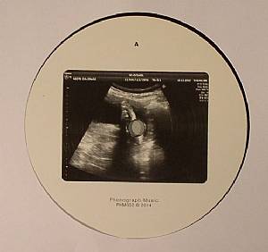 Astron EP