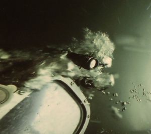 Barotrauma