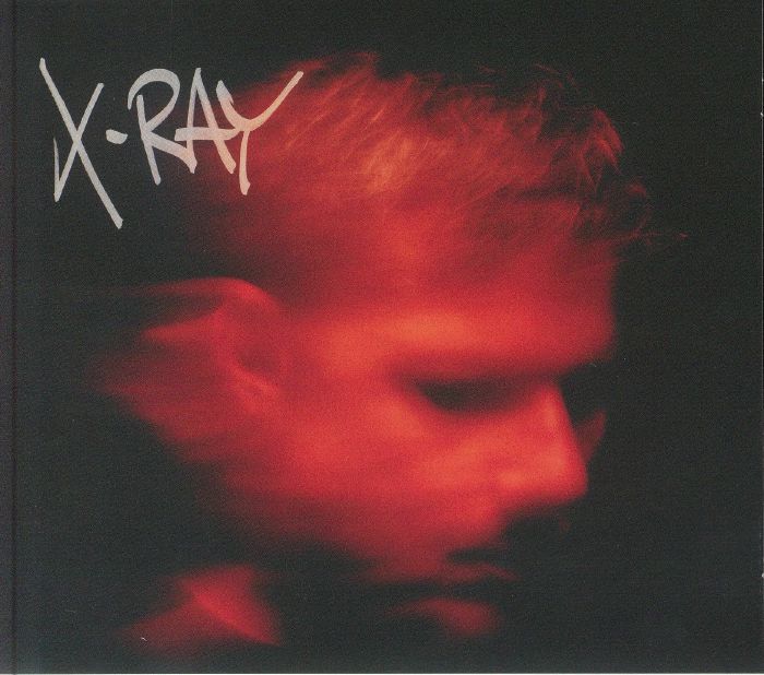 MURDOCK - X Ray